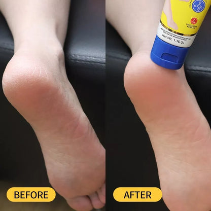 FOOT CARE™ ⭐⭐⭐⭐⭐  ELIMINA LAS GRIETAS DE TUS PIES